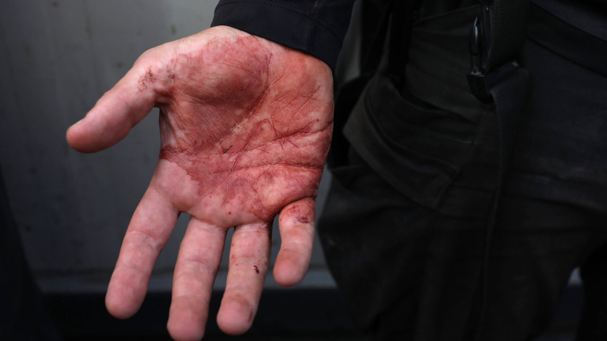 A colleague of Aysenur Eygi, an American-Turkish activist who died after reportedly being shot in the West Bank town of Beita, shows his blood-stained hand at a hospital in Nablus, West Bank, Sept. 6, 2024.